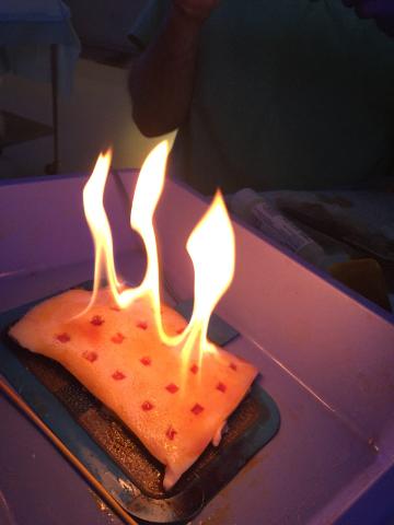 Surgical Fire with Chloroprep