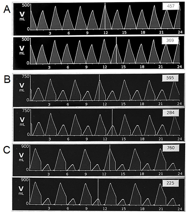 Example Tidal Volume Combinations showing devices ability to co-ventilate test lungs in alternating pattern with various volume requirements. A: 460 and 370mL. B: 600 and 285mL. C: 760 and 225ml.