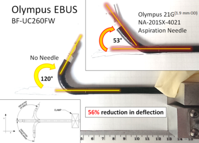56% reduction in up angle deflection subsequent to introducing a 21 gauge aspiration needle in the working channel of an Olympus scope.