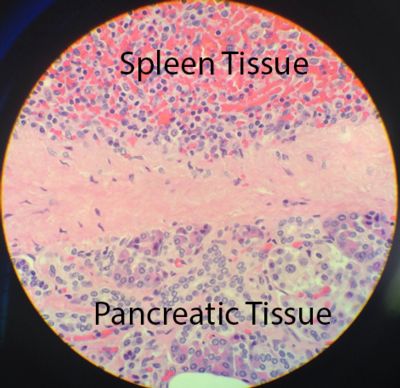 Microscopic view of Intrapancreatic Accessory Spleen