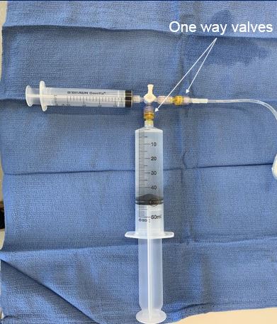 Figure 5. Two syringes: a 60 mL reservoir syringe and a 20 mL drive syringe connected via one-way valves and a T-connector