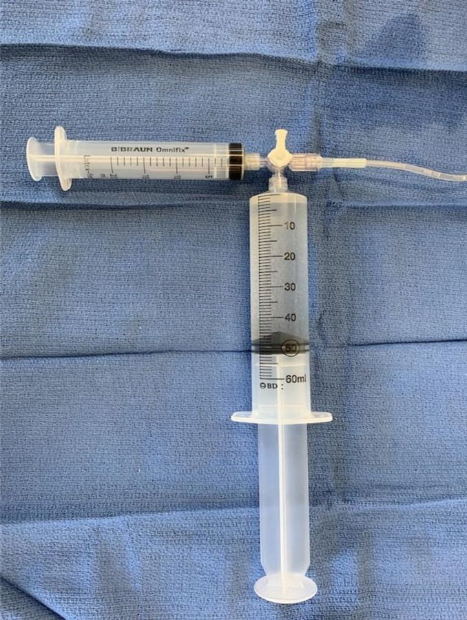 Figure 4. Two syringes: a 60 mL reservoir syringe and a 20 mL drive syringe connected via 3-way stopcock